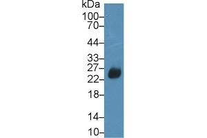 Image no. 2 for anti-DNA Fragmentation Factor, 45kDa, alpha Polypeptide (DFFA) (AA 19-262) antibody (ABIN5013466)