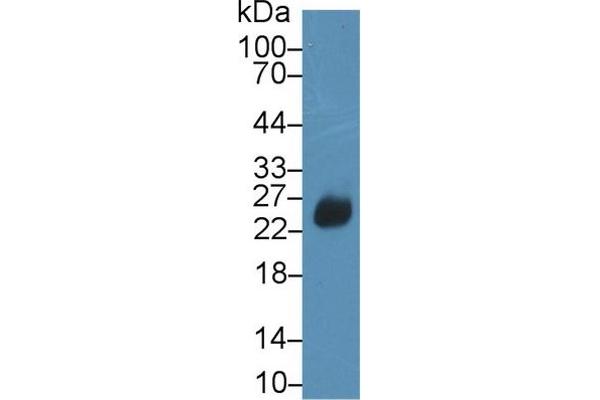 DFFA Antikörper  (AA 19-262)