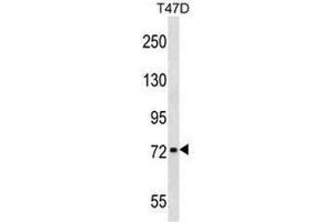 CHADL Antibody (Center) western blot analysis in T47D cell line lysates (35µg/lane).