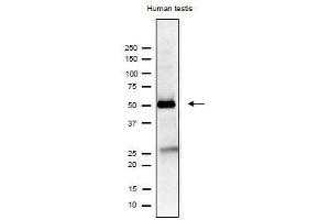 Image no. 2 for anti-Izumo Sperm-Egg Fusion 1 (IZUMO1) antibody (ABIN2452040)