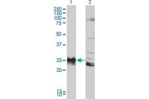 Image no. 4 for anti-Major Histocompatibility Complex, Class II, DP beta 1 (HLA-DPB1) (AA 1-258) antibody (ABIN561271)
