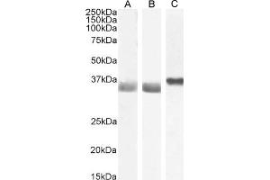 Image no. 23 for anti-Glyceraldehyde-3-Phosphate Dehydrogenase (GAPDH) (C-Term) antibody (ABIN185240)