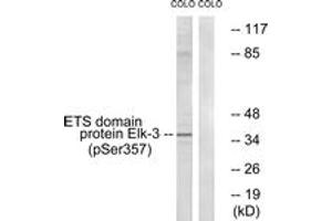 Western blot analysis of extracts from COLO205 cells treated with serum 20% 15', using Elk3 (Phospho-Ser357) Antibody.