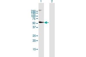 Image no. 1 for anti-Cereblon (CRBN) (AA 1-442) antibody (ABIN526543)