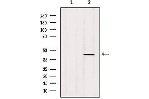 Image no. 3 for anti-Speckle-Type POZ Protein (SPOP-B) antibody (ABIN6265263)