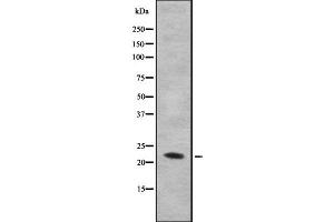 Image no. 1 for anti-Interleukin 28B (Interferon, lambda 3) (IL28B) antibody (ABIN6262561)