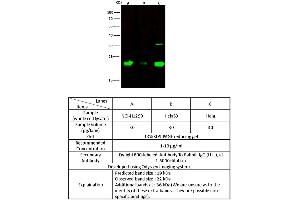 Image no. 1 for anti-Interleukin 1 Family Member 9 (IL1F9) (AA 13-164) antibody (ABIN2692482)