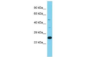 Image no. 1 for anti-NCK Interacting Protein with SH3 Domain (NCKIPSD) (C-Term) antibody (ABIN2788097)