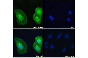 Image no. 2 for anti-T-Cell Lymphoma Invasion and Metastasis 1 (TIAM1) (C-Term) antibody (ABIN6391387)