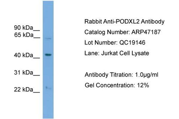 PODXL2 Antikörper  (N-Term)