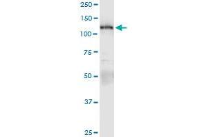 Image no. 3 for anti-Protein Kinase N1 (PKN1) (AA 1-942) antibody (ABIN950034)