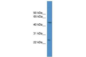 anti-DNA-Damage Regulated Autophagy Modulator 1 (DRAM1) (N-Term) antibody