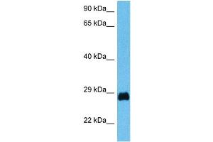 Image no. 3 for anti-Pancreatic and Duodenal Homeobox 1 (PDX1) (N-Term) antibody (ABIN2780330)