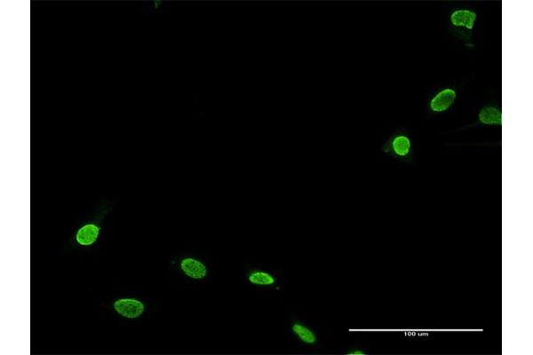 TNNI3K antibody  (AA 1-843)