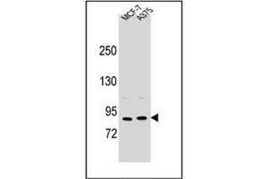 Image no. 1 for anti-Periostin (POSTN) (AA 694-724), (C-Term) antibody (ABIN954092)