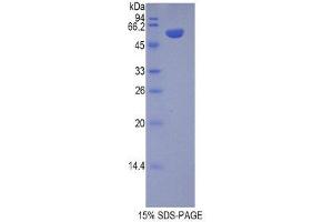 Image no. 1 for Chromogranin B (Secretogranin 1) (CHGB) (AA 40-326) protein (His tag,GST tag) (ABIN1878510)
