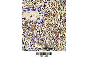 Immunohistochemistry (IHC) image for anti-Chemokine (C-C Motif) Ligand 3 (CCL3) antibody (ABIN2158092)