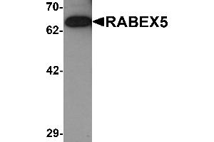 Image no. 1 for anti-RAB Guanine Nucleotide Exchange Factor (GEF) 1 (RABGEF1) (C-Term) antibody (ABIN1030611)