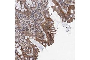 TMEM39B antibody