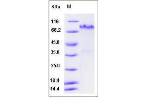 Image no. 1 for Notch 1 (NOTCH1) (AA 1-526) (Active) protein (His tag) (ABIN2008115)