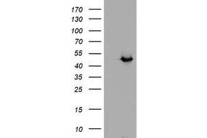 Image no. 2 for anti-Alcohol Dehydrogenase 7 (Class IV), mu Or sigma Polypeptide (ADH7) antibody (ABIN2715883)