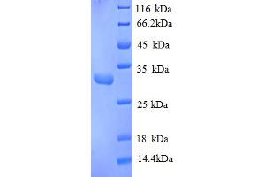 Image no. 1 for Replication Protein A4, 30kDa (RPA4) (AA 1-260), (partial) protein (His tag) (ABIN5713010)