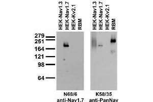 Adult rat brain membrane (RBM) and transfected cell immunoblot: extracts of RBM and HEK-293 cells stably expressing Nav1.