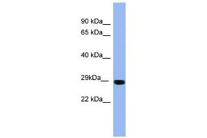 Image no. 1 for anti-RAB1A, Member RAS Oncogene Family (RAB1A) (Middle Region) antibody (ABIN2786772)