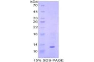 Image no. 3 for Bone Morphogenetic Protein 7 (BMP7) ELISA Kit (ABIN6730953)