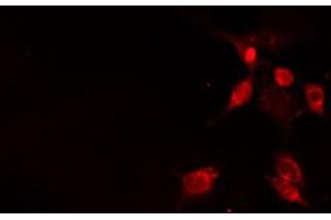 Image no. 1 for anti-Nuclear Factor of Activated T-Cells, Cytoplasmic, Calcineurin-Dependent 2 Interacting Protein (NFATC2IP) antibody (ABIN6263627)