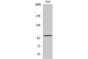 Image no. 1 for anti-Actinin, alpha 3 (ACTN3) (N-Term) antibody (ABIN3183164)