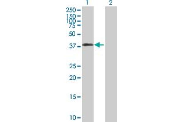 anti-DNA Fragmentation Factor, 45kDa, alpha Polypeptide (DFFA) (AA 1-331) antibody