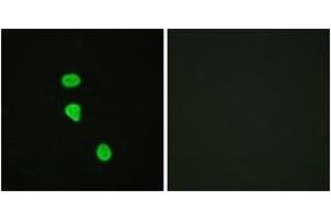 Immunofluorescence analysis of HeLa cells, using AS160 (Phospho-Thr642) Antibody.