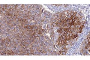 Image no. 2 for anti-Macrophage Scavenger Receptor 1 (MSR1) antibody (ABIN6263400)