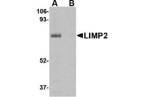 Western Blotting (WB) image for anti-Scavenger Receptor Class B, Member 2 (SCARB2) (Middle Region) antibody (ABIN1030987)