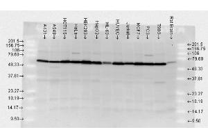 Image no. 7 for anti-Heat Shock Protein 70 (HSP70) antibody (Alkaline Phosphatase (AP)) (ABIN2486671)