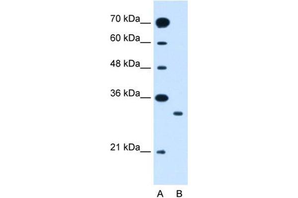 anti-Solute Carrier Family 25 (Mitochondrial Carrier: Glutamate), Member 22 (SLC25A22) (N-Term) antibody