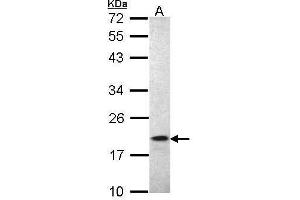 Image no. 6 for anti-Allograft Inflammatory Factor 1 (AIF1) (C-Term) antibody (ABIN2857032)