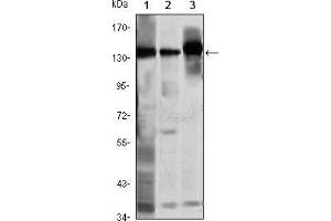 Image no. 4 for anti-Structural Maintenance of Chromosomes 1A (SMC1A) antibody (ABIN969406)