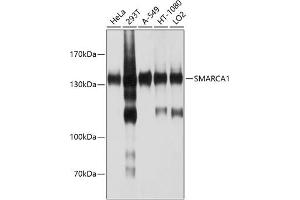 SMARCA1 抗体  (AA 1-200)