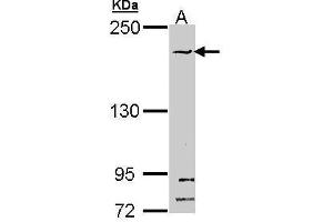 Image no. 2 for anti-Structural Maintenance of Chromosomes 1B (SMC1B) (N-Term) antibody (ABIN2856836)