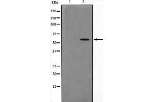 Image no. 2 for anti-P21-Activated Kinase 4 (PAK4) (Internal Region) antibody (ABIN6266374)