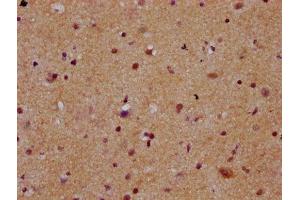 IHC image of ABIN7168374 diluted at 1:300 and staining in paraffin-embedded human brain tissue performed on a Leica BondTM system.