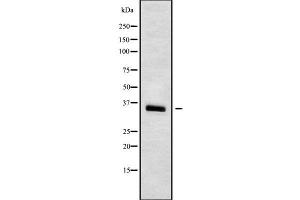 Image no. 2 for anti-Solute Carrier Family 25 (Mitochondrial Carrier, Adenine Nucleotide Translocator), Member 5 (SLC25A5) (Internal Region) antibody (ABIN6265122)
