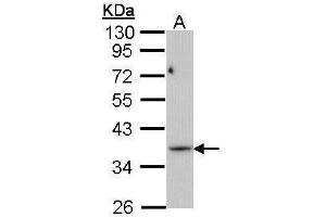 Image no. 1 for anti-phosphoribosyl Pyrophosphate Synthetase 1-Like 1 (PRPS1L1) (full length) antibody (ABIN2856839)