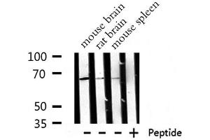 Image no. 1 for anti-Replication Protein A1, 70kDa (RPA1) (Internal Region) antibody (ABIN6264808)