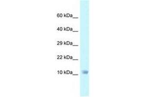 Image no. 1 for anti-NADH Dehydrogenase (Ubiquinone) 1 alpha Subcomplex, 6, 14kDa (NDUFA6) (C-Term) antibody (ABIN6747754)