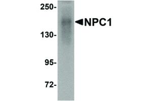 Image no. 1 for anti-Niemann-Pick Disease, Type C1 (NPC1) (C-Term) antibody (ABIN6655360)
