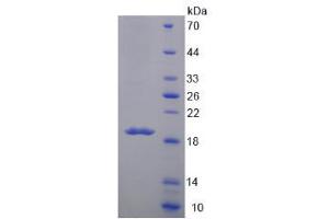 Image no. 1 for Mucin 5 Subtype B (MUC5B) (AA 6489-6632) protein (His tag) (ABIN6238624)