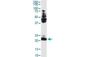 anti-Transcription Elongation Factor A (SII)-Like 3 (TCEAL3) (AA 1-200) antibody